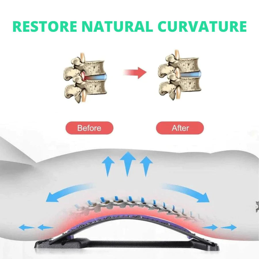 ESENT™ | Back Stretcher